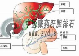 胆结石的发现